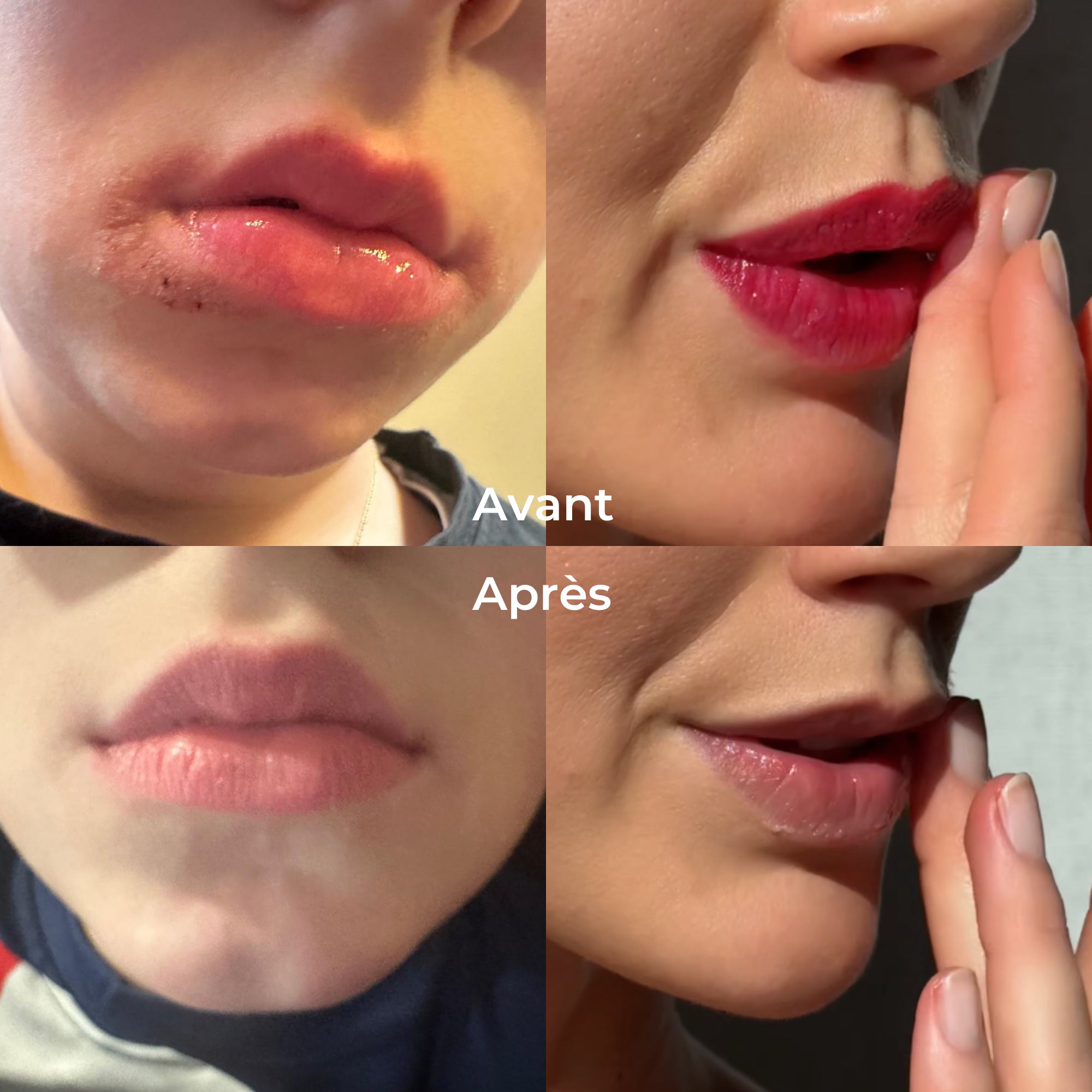 les-petits-pr-diges-le-baume-magique-sans-parfum-baume-multi-usages image 3