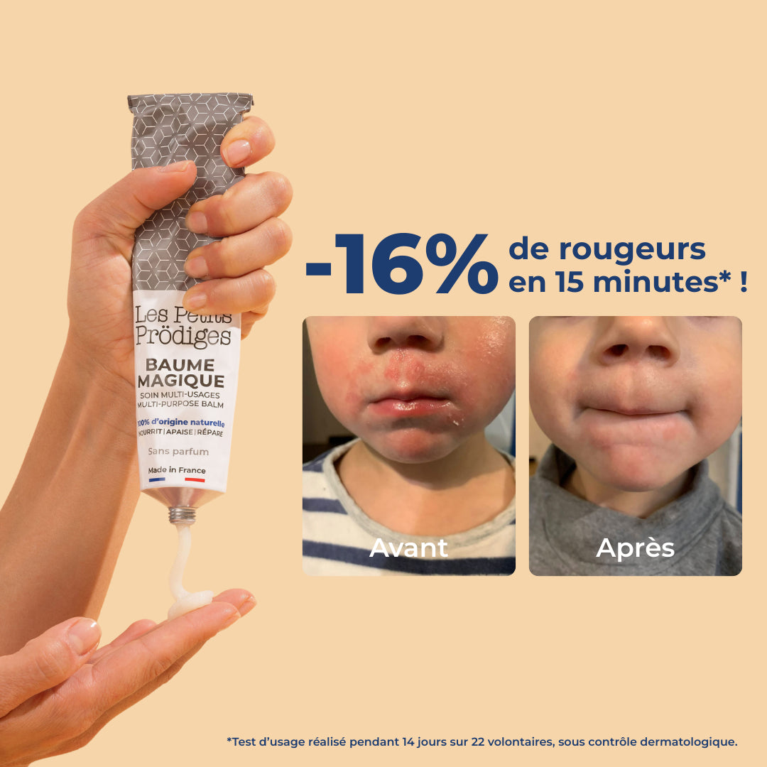 les-petits-pr-diges-les-baumes-magiques-en-tube-duo-20ml-sans-parfum-10-en-1 image 5
