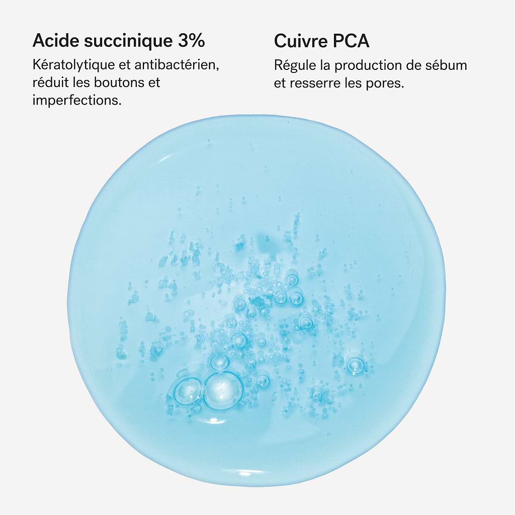 typology-s-rum-imperfections-jour-acide-succinique-3-cuivre-pca image 4