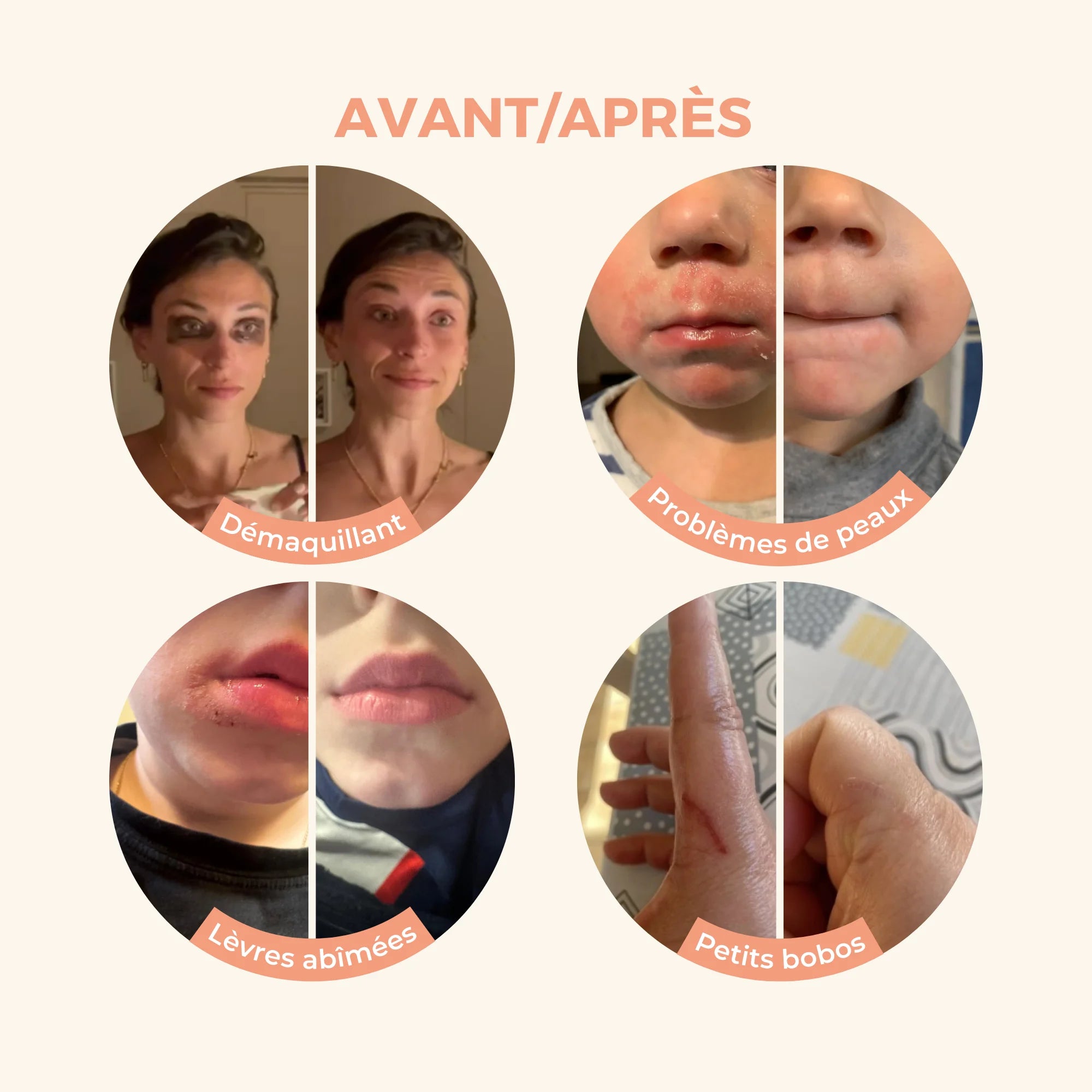 les-petits-pr-diges-le-baume-magique-cbd-baume-multi-usages image 3