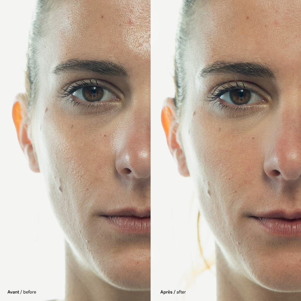 typology-gommage-visage-imperfections-soufre-2-extrait-d-ortie image 5