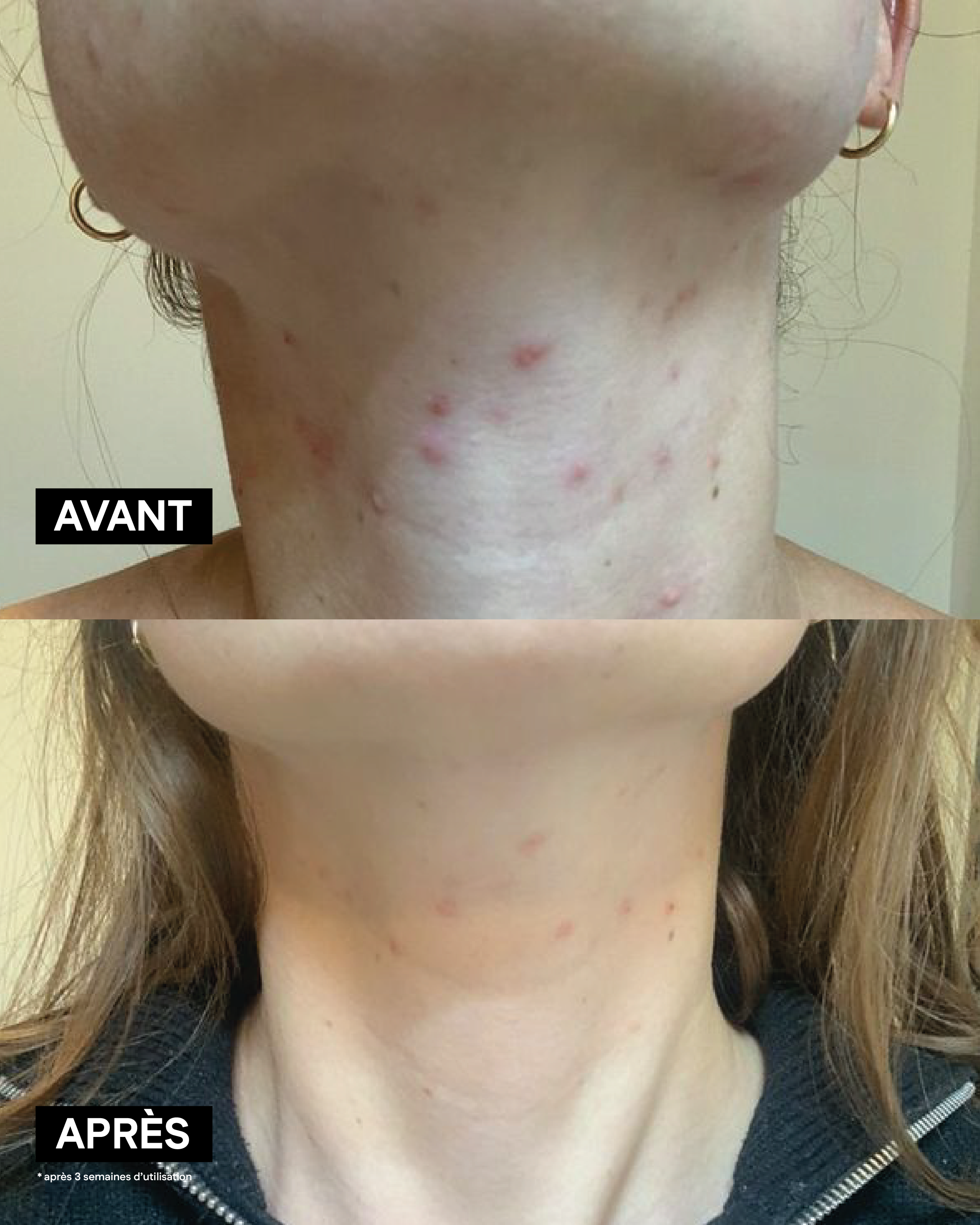 cl-mence-vivien-trio-purifiant-anti-imperfections-210-ml image 5
